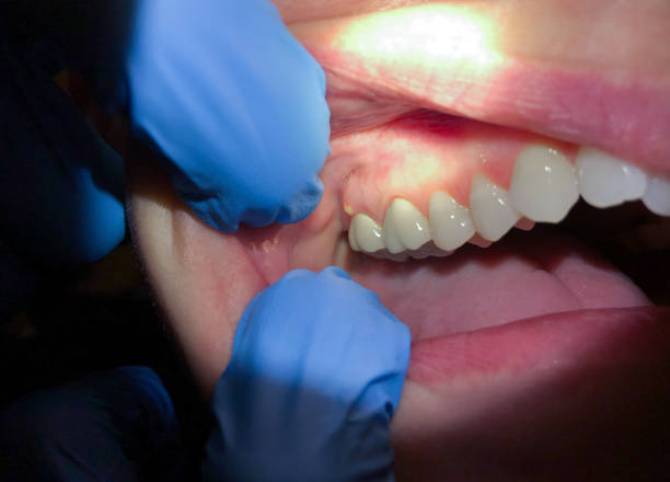 Best Mobile Emergency Dentist in Lavonia, GA