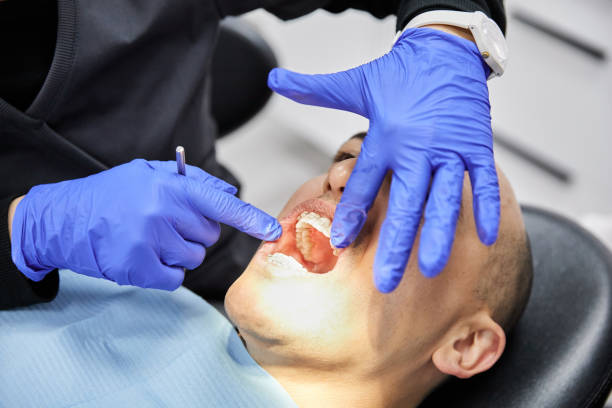 Best Emergency Dental Extractions in Lavonia, GA